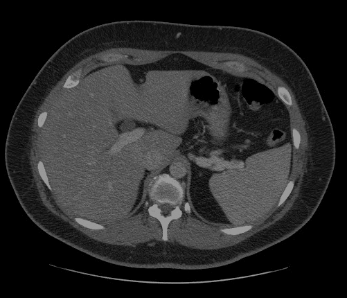 Protected and watermarked picture as part of site or resource